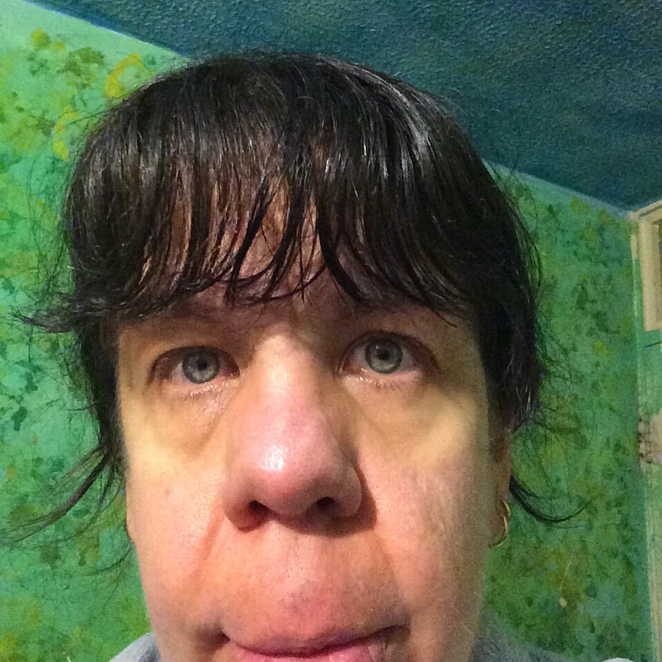 Trying to Get Naturally Healthy Skin in Just One Month – Week&nbsp;1